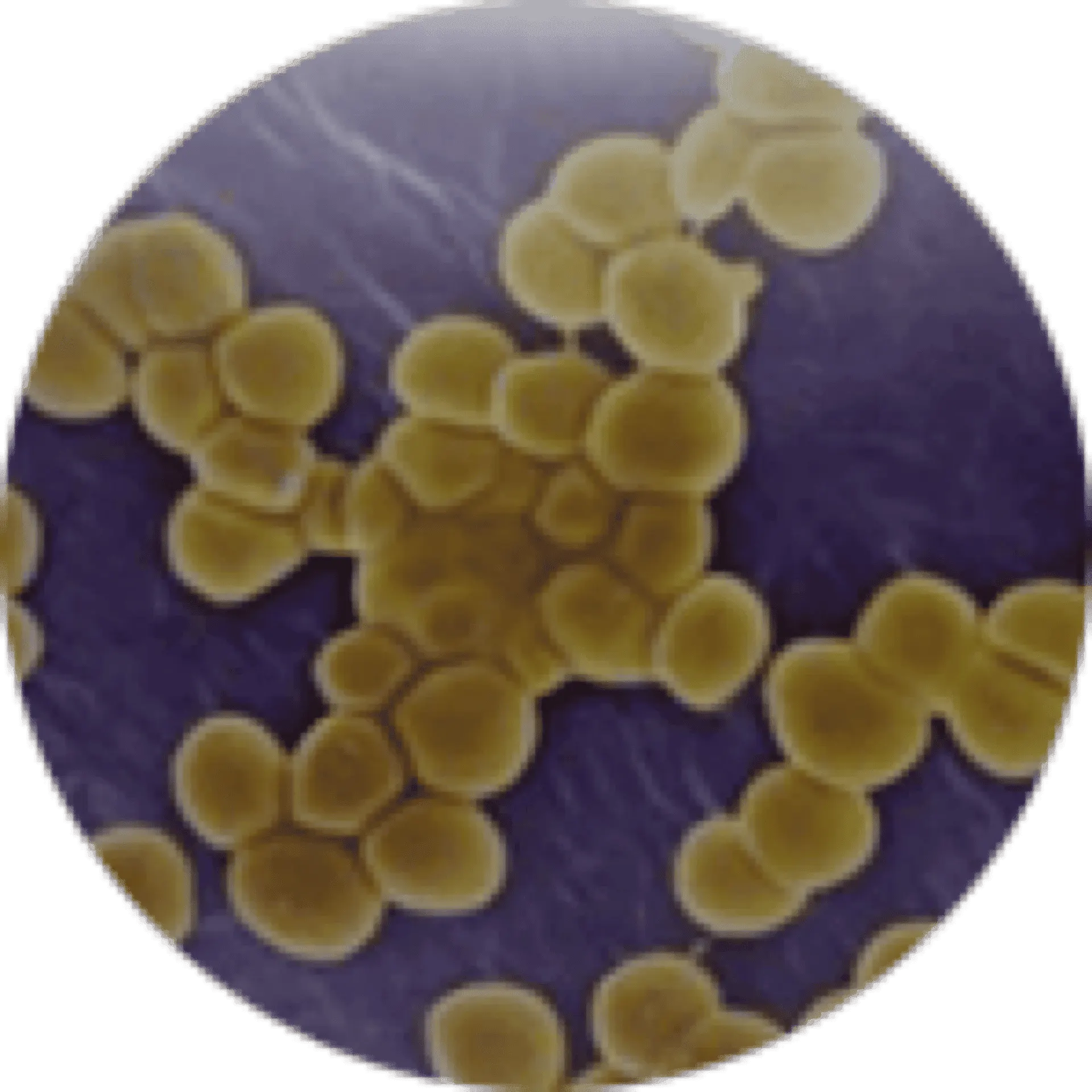 Staphylococcus aureus