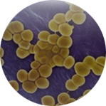 Staphylococcus aureus